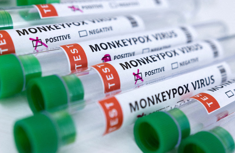  Test tubes labeled "Monkeypox virus positive and negative" are seen in this illustration taken May 23, 2022 (photo credit: REUTERS/DADO RUVIC)