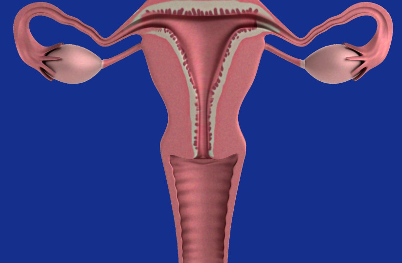 Illustrative image of a uterus (photo credit: PIXABAY)