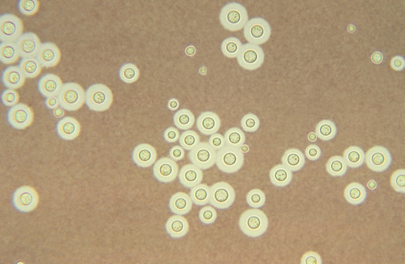 Cryptococcus neoformans (credit: CDC/DR. LEANOR HALEY/PUBLIC DOMAIN/VIA WIKIMEDIA COMMONS)