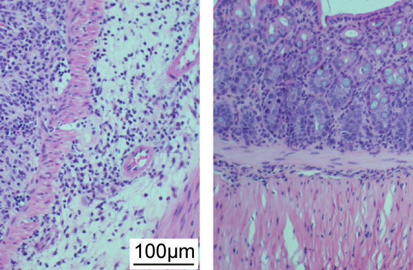  Intestinal lining of mice was damaged when exposed to inflammation-causing bacterial strains (left); the damage was attenuated when the mice were given a 5-phage cocktail targeting these bacterial strains (right) (photo credit: WEIZMANN INSTITUTE OF SCIENCE)