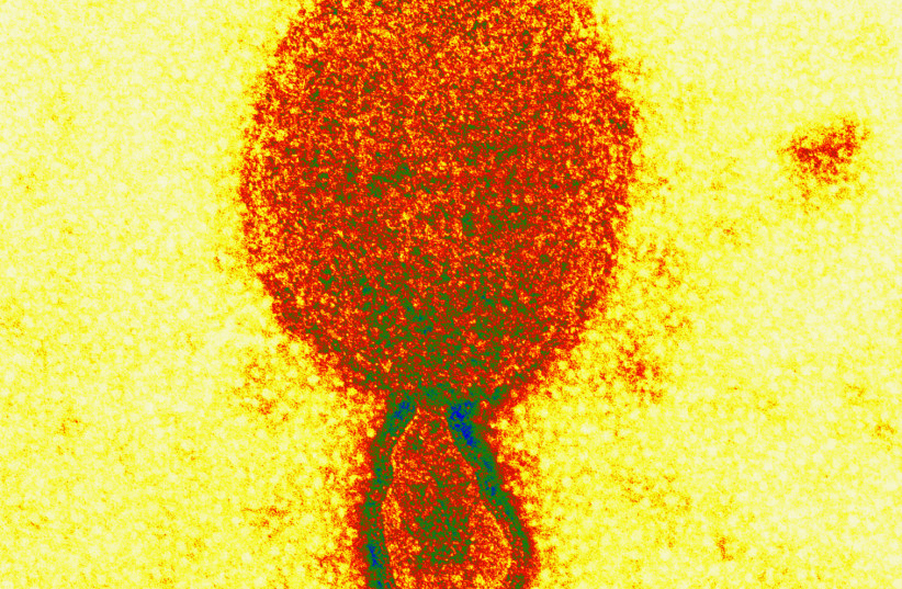  Hendra virus (photo credit: Electron Microscopy Unit AAHL, CSIRO)
