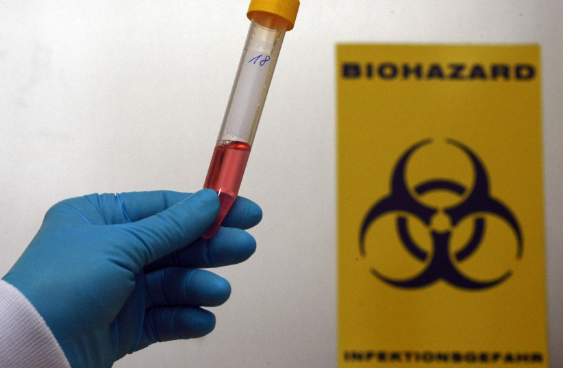  A technician poses for the media with a test tube for testing against pandemic influenza A (H1N1) virus in the national reference laboratory at the Robert Koch scientific institute in Berlin, October 2, 2009 (photo credit: Fabrizio Bensch/Reuters)