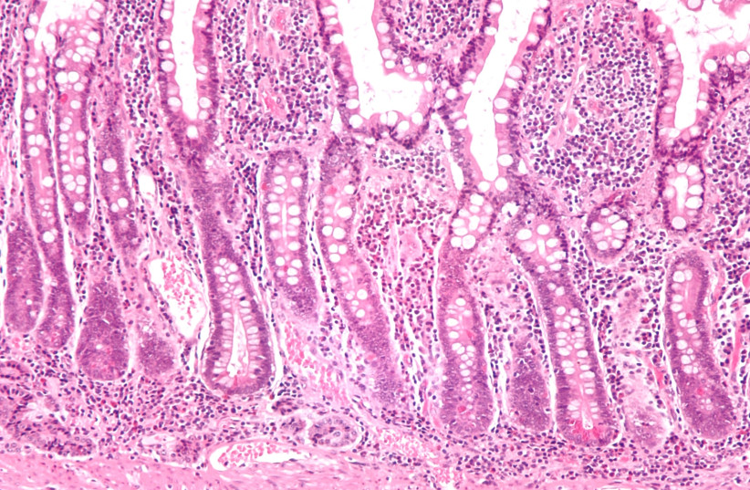Low magnification micrograph of small intestinal mucosa. (photo credit: NEPHRON/CC BY-SA 3.0 (https://creativecommons.org/licenses/by-sa/3.0)/VIA WIKIMEDIA COMMONS)