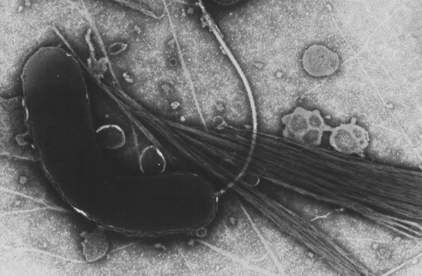 Transmission electron microsope image of Vibrio cholerae, the bacteria responsible for cholera. (photo credit: Tom Kirn, Ron Taylor, Louisa Howard - Dartmouth Electron Microscope Facility)