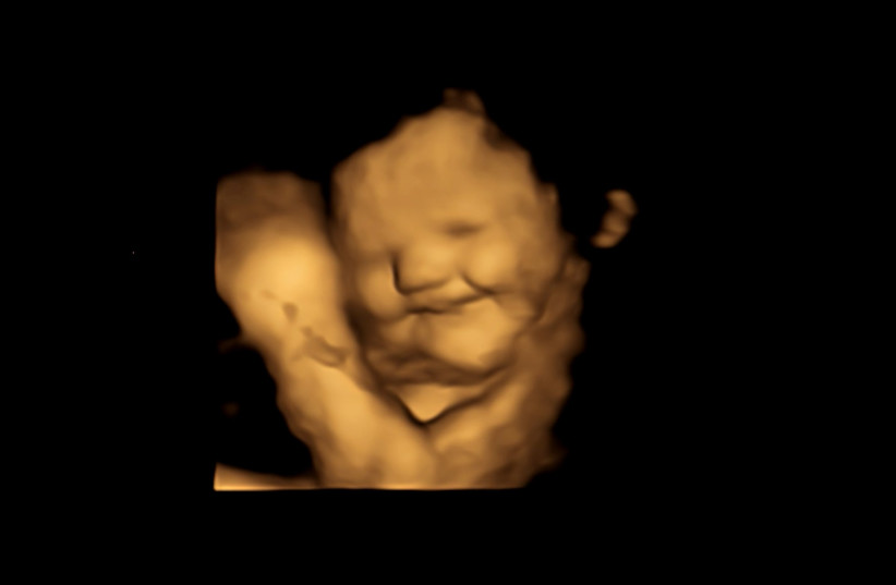  A 4D scan image of the same fetus showing a laughter-face reaction after being exposed to carrot (photo credit: DURHAM UNIVERSITY)