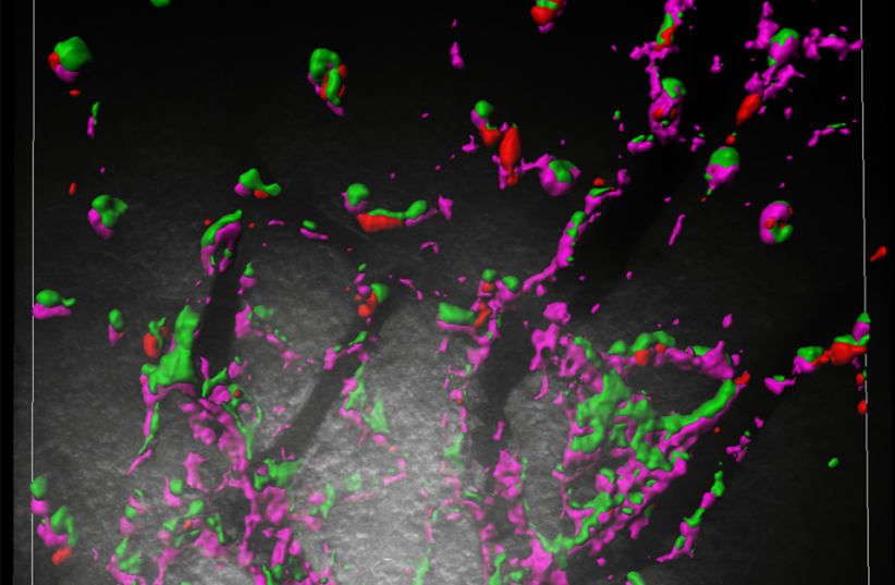   Image of RTL6 protein clustering around a bacteria-mimic in a mouse brain. (photo credit: The Company of Biologists)
