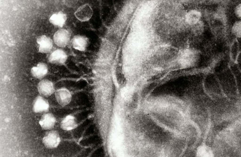 How do viruses outwit cellular immune systems? - study - Vimarsana News