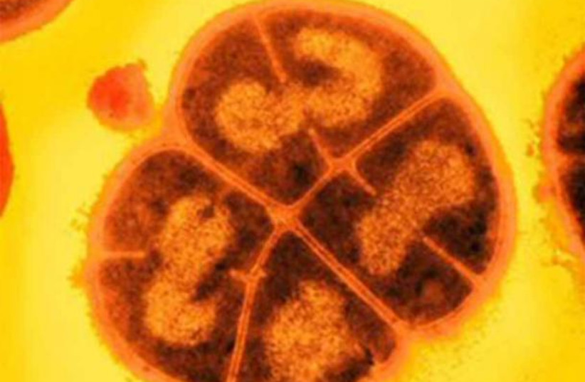 Is there life on Mars? Conan the Barbarian bacteria suggests maybe-study - Vimarsana News