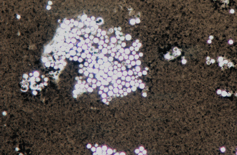  Cryptococcus neoformans (credit: Wikimedia Commons)