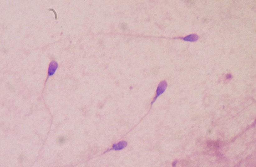 Human sperm stained for semen quality testing in a clinical laboratory. (photo credit: BOBJGALINDO/CC BY-SA 4.0 (https://creativecommons.org/licenses/by-sa/4.0)/VIA WIKIMEDIA COMMONS)