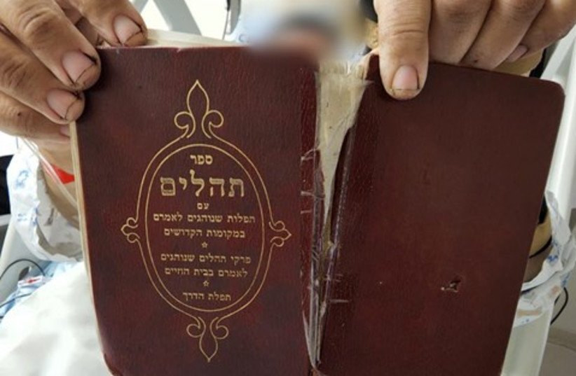  The book of psalms the victim had with him at the time prevented a shard of debris from piercing his body.  (photo credit: SHAARE ZEDEK MEDICAL CENTER)