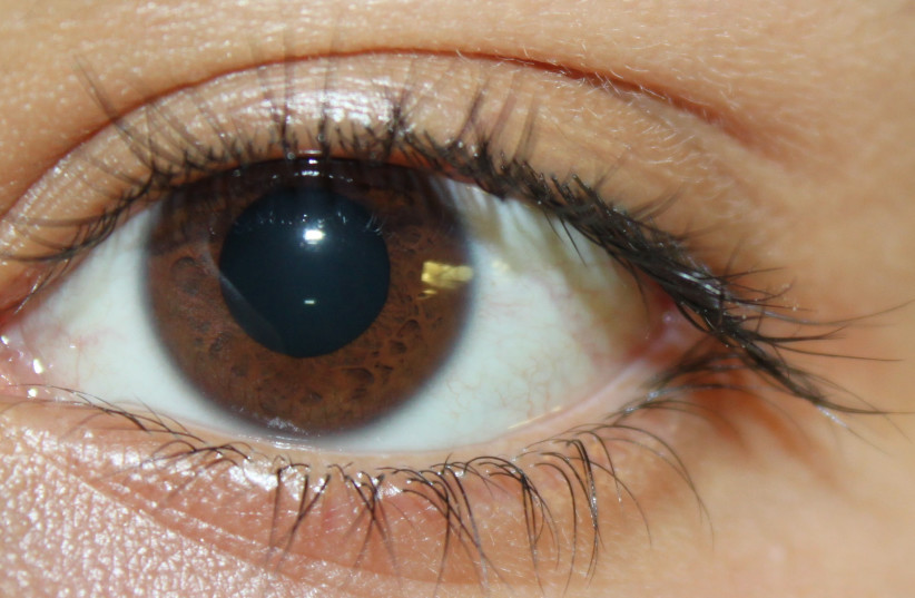  A brown eye (photo credit: Wikimedia Commons)