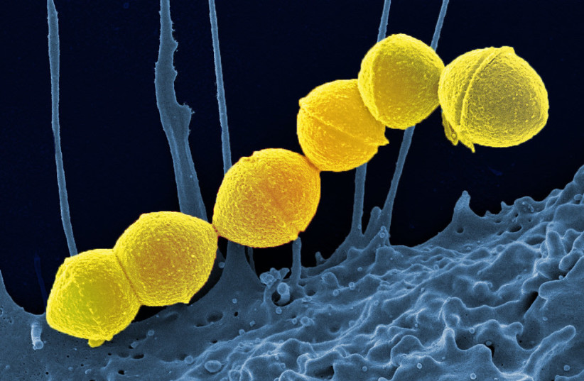 Strep A bacteria. (photo credit: FLICKR)