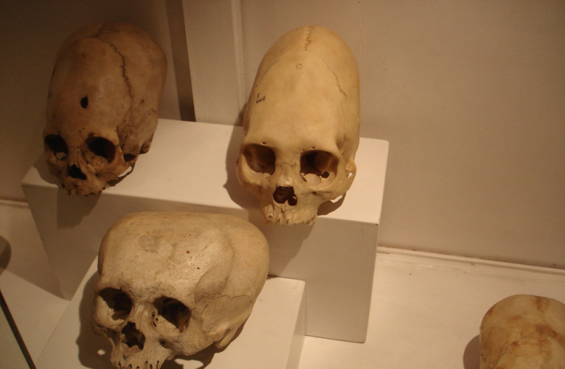  Elongated skulls at the Inca museum (photo credit: FLICKR)