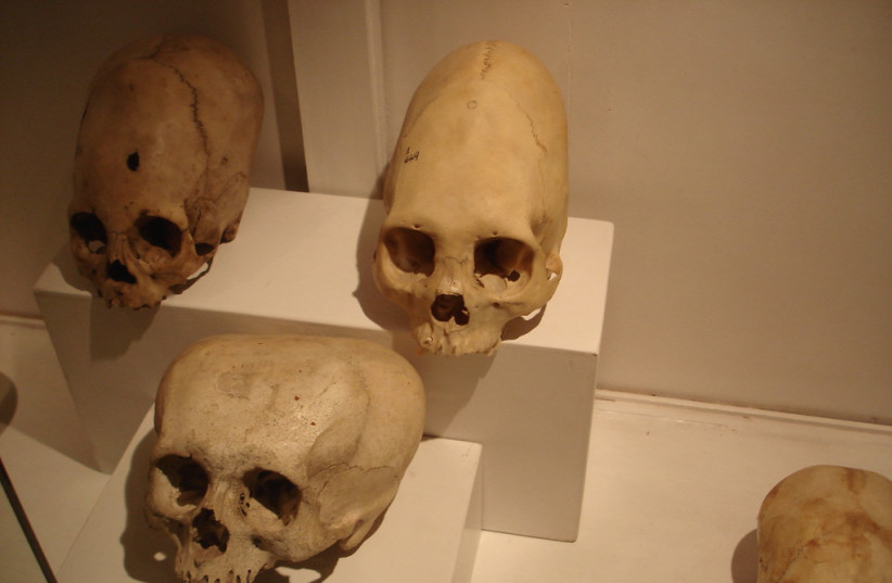 Why did the ancients of Peru paint their ancestors' skulls red? - study - Vimarsana News