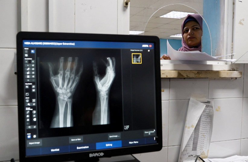  A Palestinian woman looks through a small window at the X-ray unit in Shifa hospital in Gaza City, January 5, 2023. (credit: IBRAHEEM ABU MUSTAFA/REUTERS)