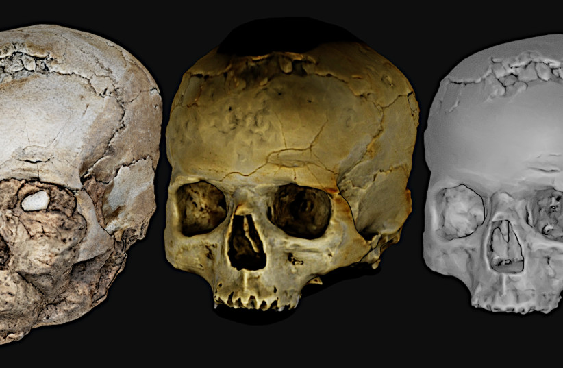  Scans of the Jericho Skull.  (credit: Cicero Moraes et al. /CC BY 4.0 / Ortogonline)