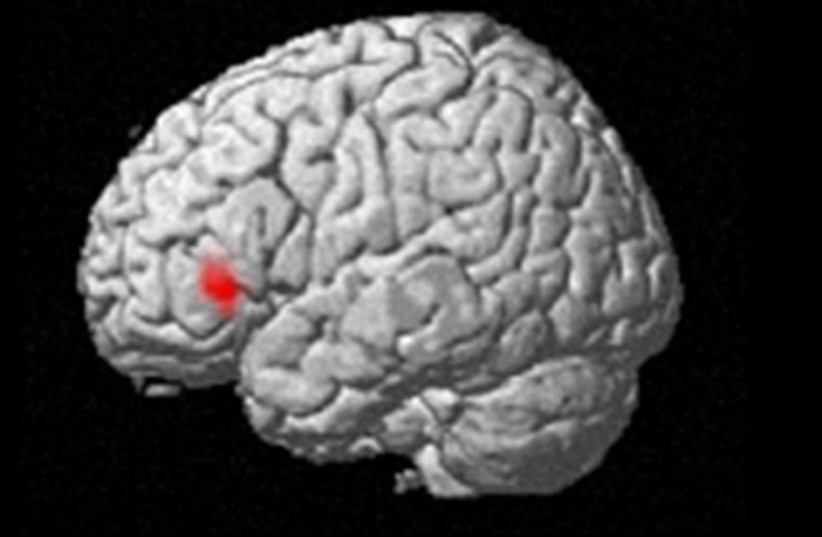  Scientists show that in the inferior frontal gyrus, neural activity differs in response to food images, depending on whether those images are presented consciously or unconsciously. this difference was associated with scores on eating behaviors such as emotional eating and restrained eating.  (photo credit: OSAKA METROPOLITAN UNIVERSITY)