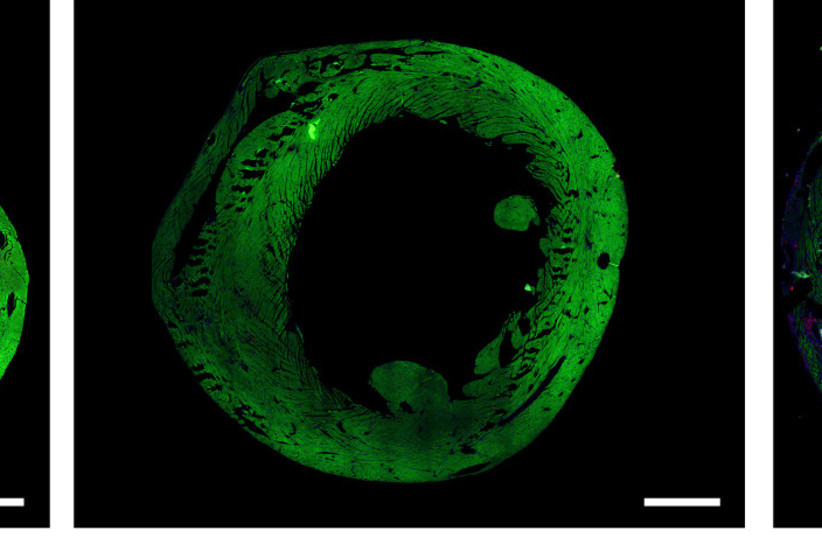  The importance of redifferentiation: Proteins responsible for heart muscle contraction (green) are abundant in a healthy heart (left) and in a heart whose muscle cells had undergone successful redifferentiation after injury (center), but not in a heart whose cells failed to undergo processes. (photo credit: WEIZMANN INSTITUTE OF SCIENCE)
