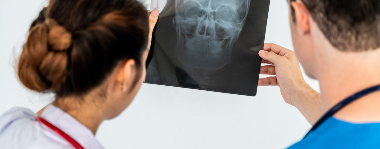  Female doctor looking at x ray film of patient head injury while working with another doctor at the hospital. Medical healthcare staff and doctor service.