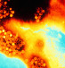 Hepatitis A virus (HVA) causes acute inflammation of the liver and is the most common of all forms of viral hepatitis
