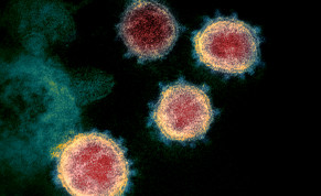 This undated transmission electron microscope image shows SARS-CoV-2, also known as novel coronavirus, the virus that causes COVID-19, isolated from a patient in the U.S. Virus particles are shown emerging from the surface of cells cultured in the lab. The spikes on the outer edge of the virus parti