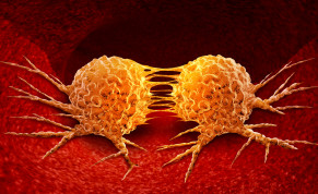  Dividing cancer cell