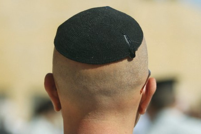 The bald truth - The Jerusalem Post