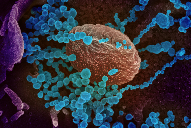  Scanning electron microscope image shows SARS-CoV-2, also known as novel coronavirus (photo credit: U.S. NIAID-RML/Handout via REUTERS)