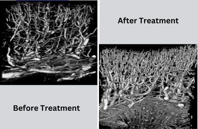 Before and after treatment with Curespec's Nephrospec (Credit: Courtesy of Curespec)