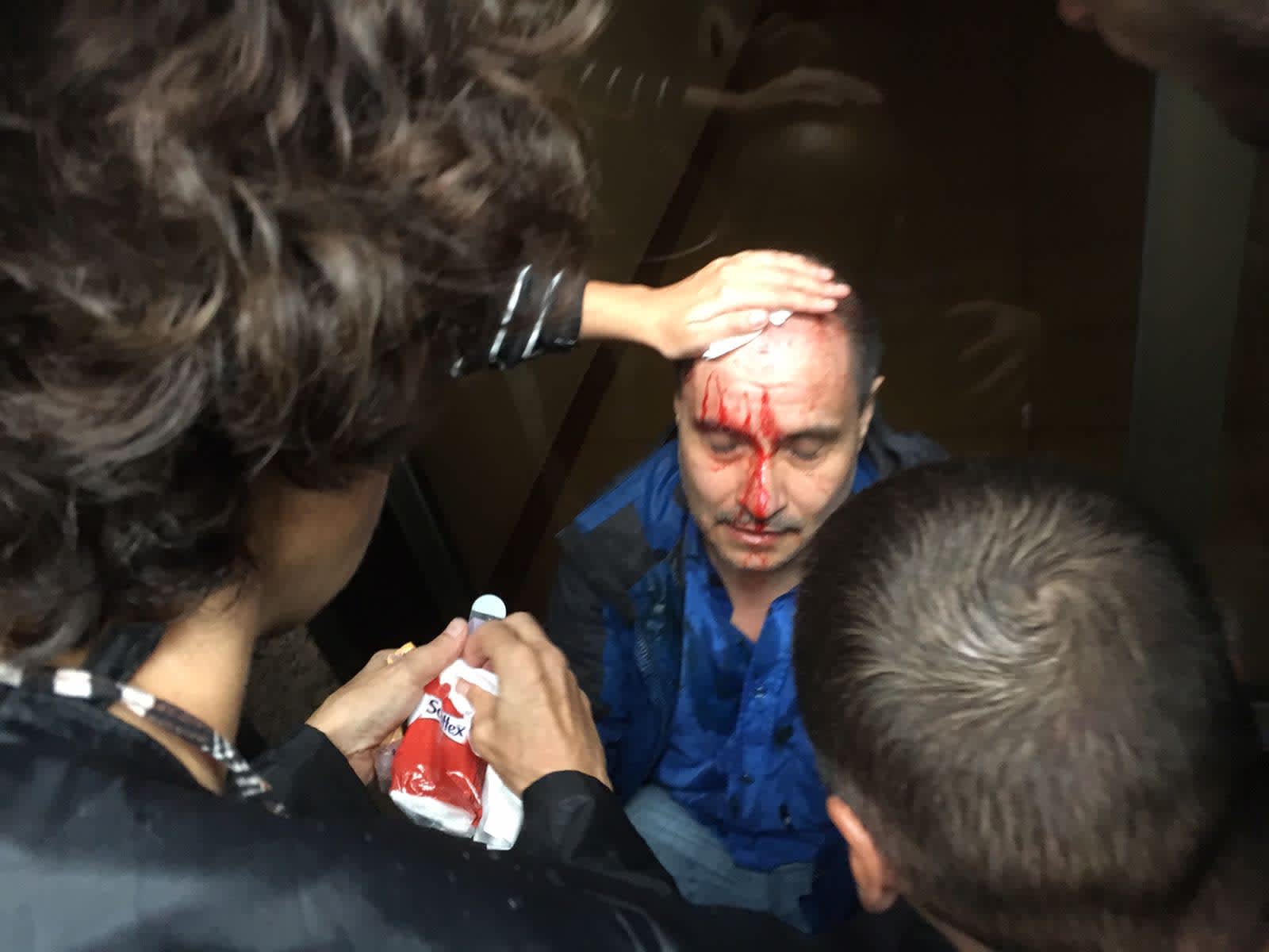 A Catalan man injured by a rubber bullet (credit: MK Ksenia Svetlova) 
