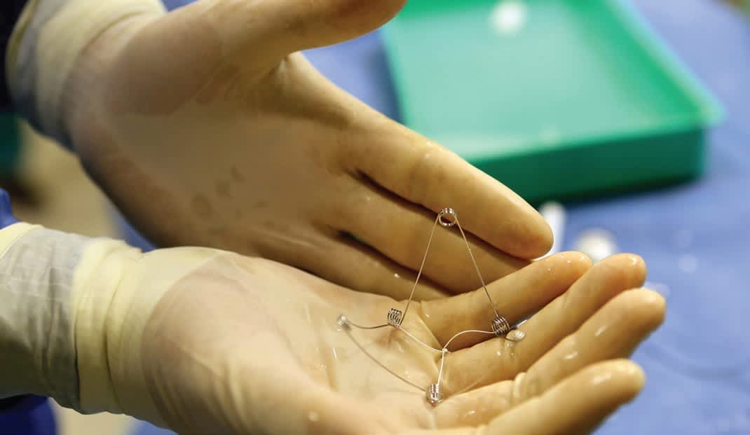 An Israeli device that can be inserted into a patient's heart to treat congestive heart failure. (Piotr Flitr)