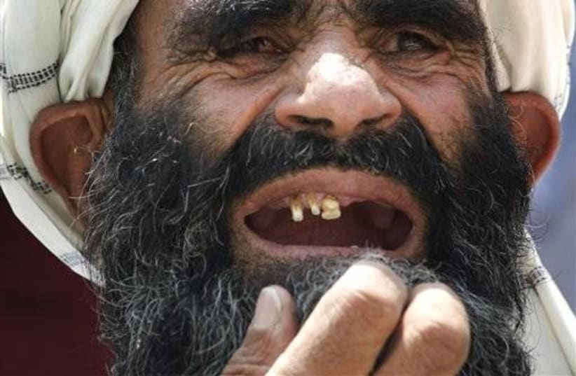 gallery_toothless old man (photo credit: Associated Press)