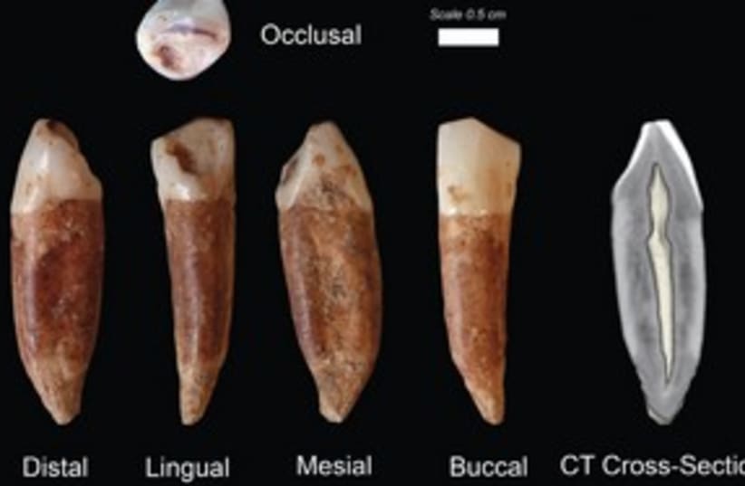 Teeth from Qesem cave 311 (photo credit: Prof. Israel Hershkowitz/TAU)