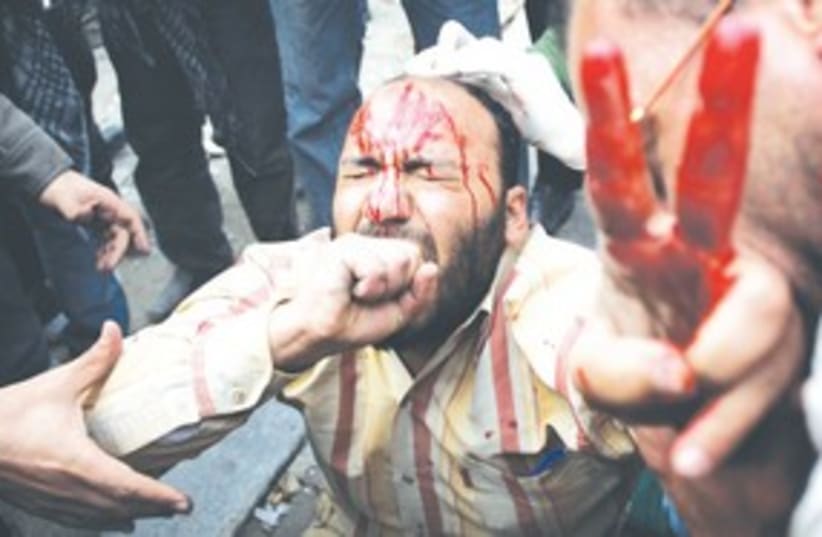 Bloodied Egyptian protester peace sign 311 AP (photo credit: AP)