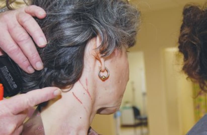 Bat attacks woman 370 (photo credit: Courtesy Kaplan Medical Center)