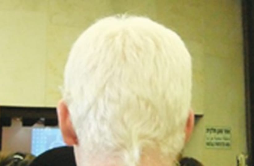An albino man370 (photo credit: Judy Siegel-Itzkovich)