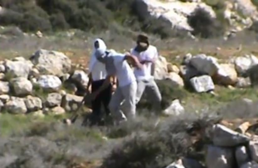 Settlers attack activist. (photo credit: Courtesy)