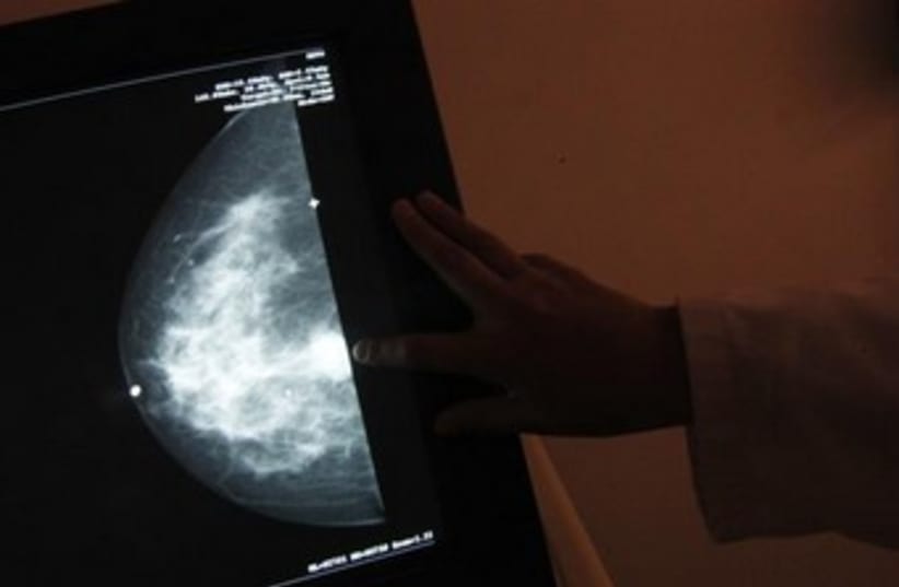 A monitor shows the image of a woman infected with breast cancer. (photo credit: REUTERS)