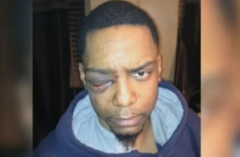 Victim Taj Patterson, after being attacked  (photo credit: screenshot)