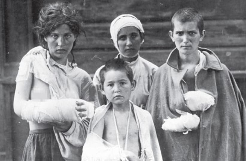 Child victims of a pogrom carried out under the inspiration of Simon Petlura in Ukraine in 1919. (photo credit: JERUSALEM POST ARCHIVE)