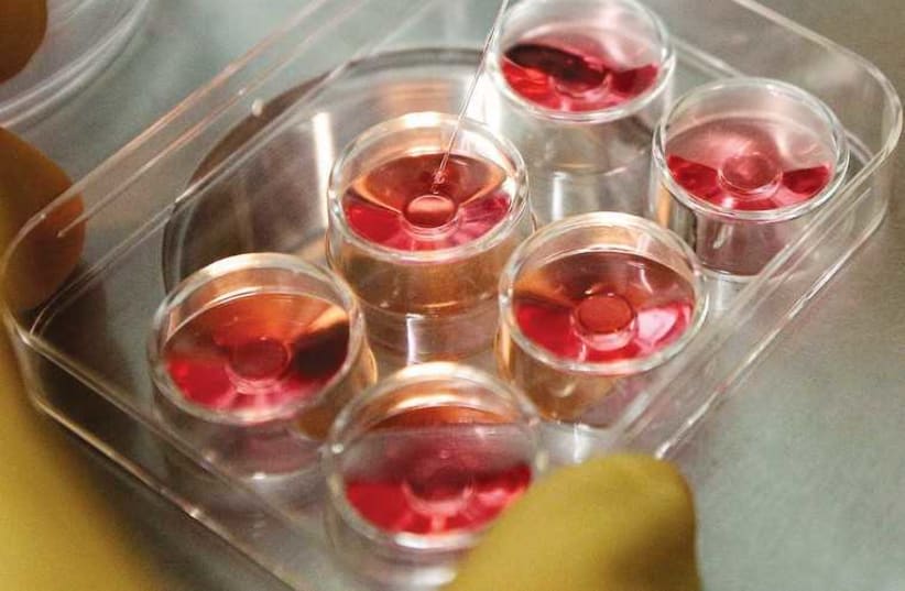 The process of extracting eggs in a lab in a fertility clinic. (photo credit: REUTERS)