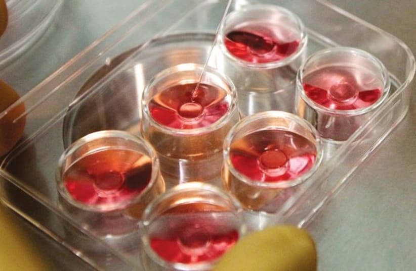 The process of extracting eggs in a lab in a fertility clinic. (photo credit: REUTERS)