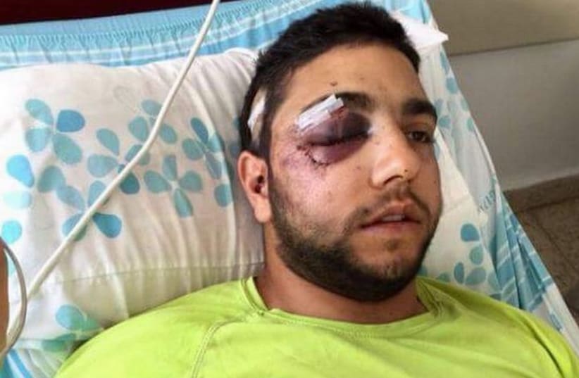 Druse IDF soldier Razzi Houseysa in hospital after beating (photo credit: AMIR HOUSEYSA)