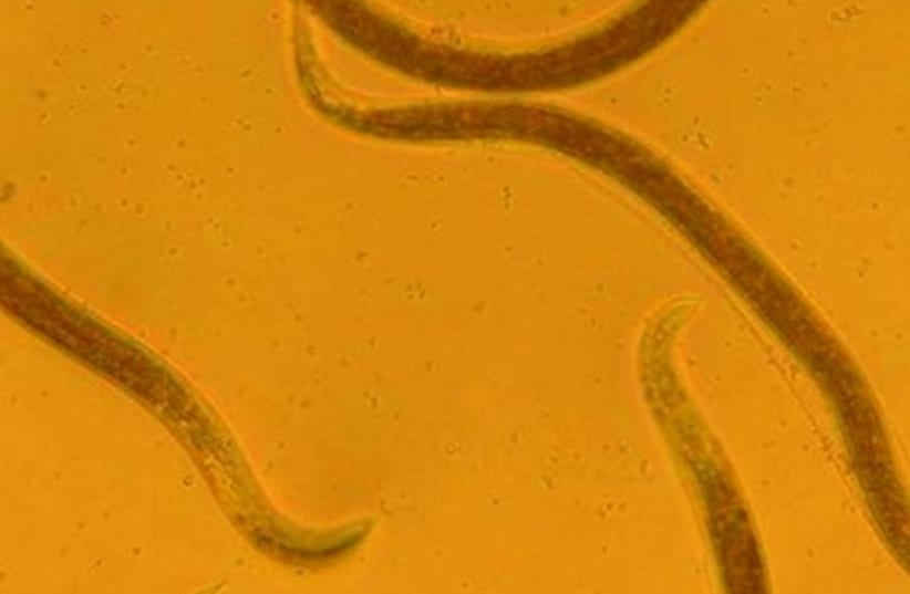 Nematode worms. (photo credit: BIOBEE)