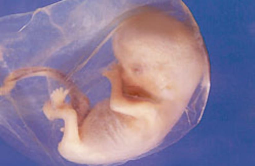 embryo 88 248 (photo credit: Life Issues Institute)