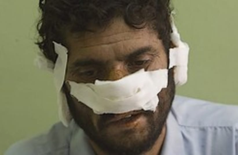 nose and ears cut off by Taliban 248.88 (photo credit: )
