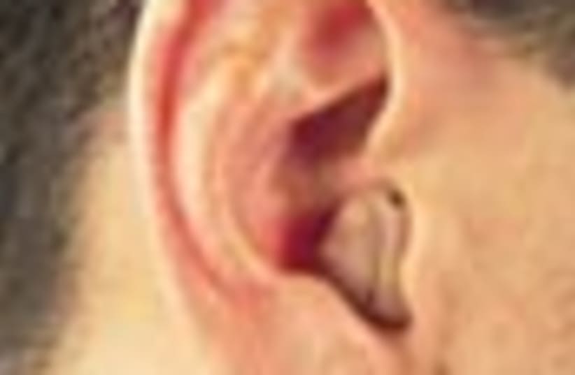 hearing aid 88 (photo credit: )