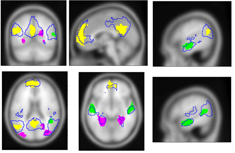 MRI scans show simultaneous activity of three cognitive systems creates internal experiences (photo credit: BAR ILAN UNIVERSITY)
