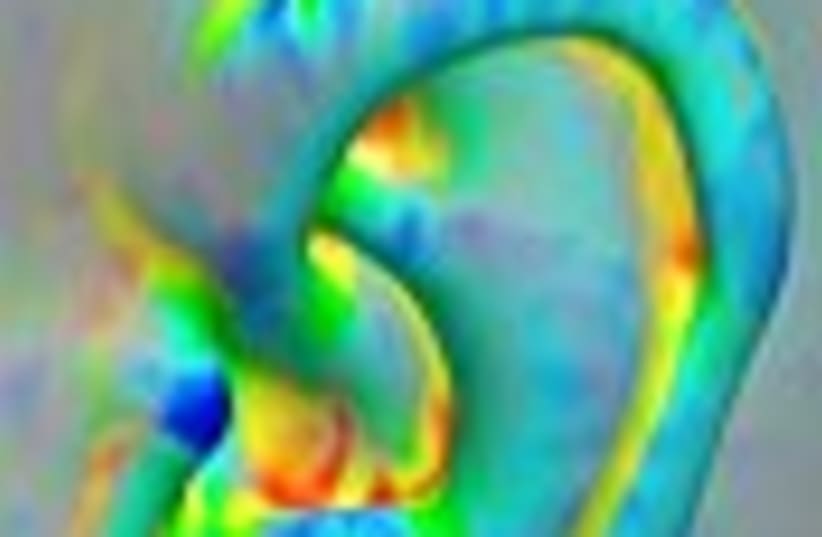 psychedelic ear 88 (photo credit: )